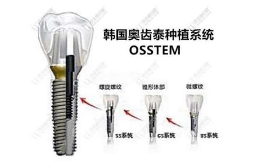 http://m.bstoo.cn/d/file/price/gcsdesbxrj.jpg