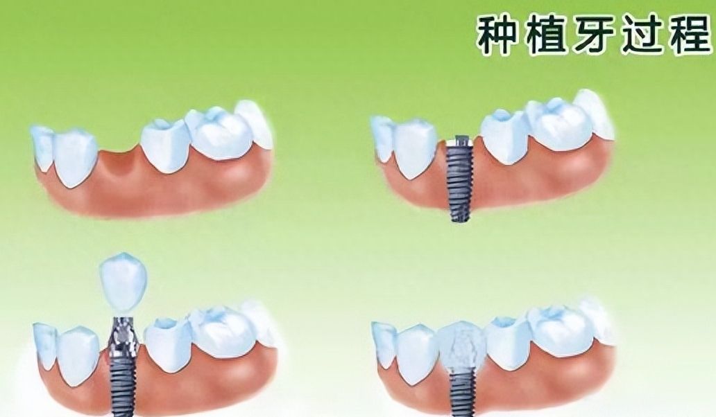 ?？诙c口腔收費標準：了解價格明細，透明消費！