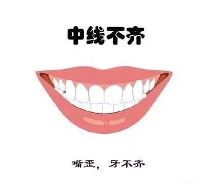 西寧牙齒矯正費用一覽，隱形矯正價格參考指南