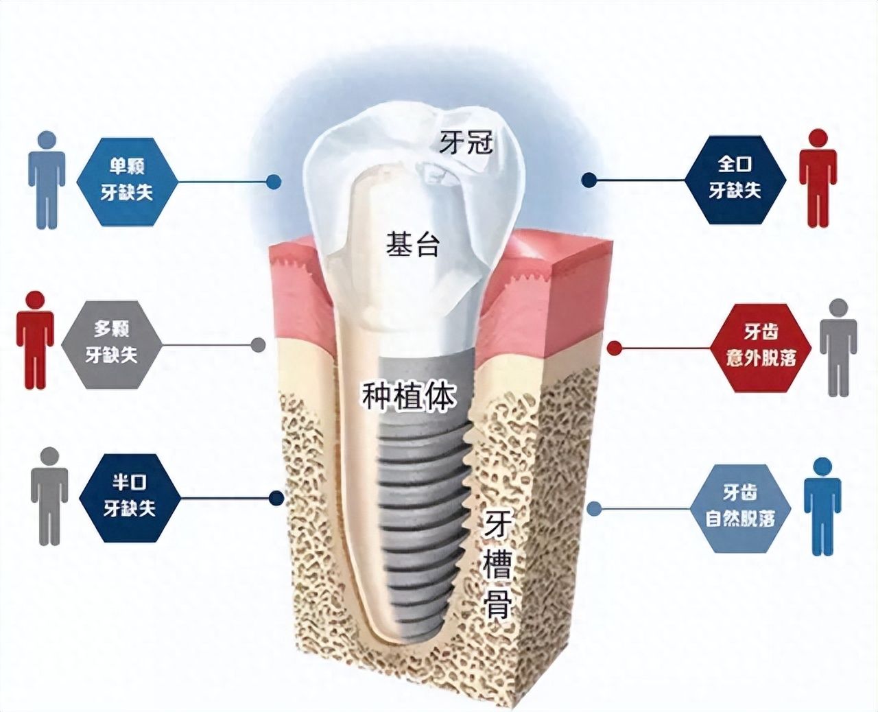 http://m.bstoo.cn/d/file/price/hll93h93qm2f.jpg