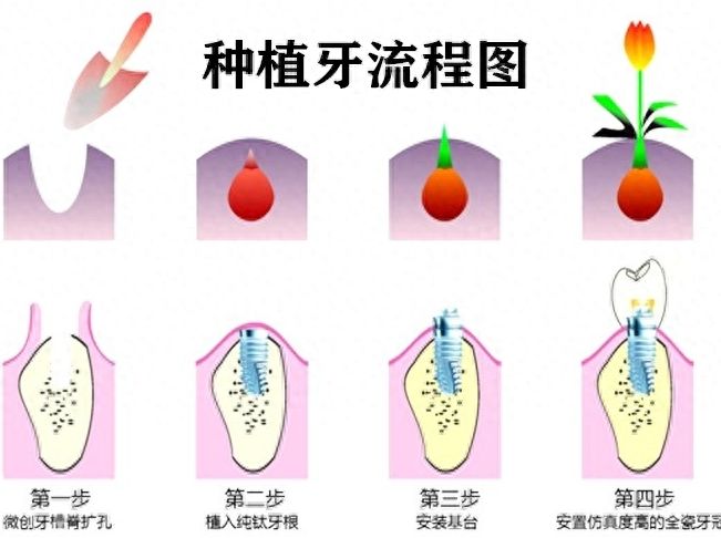 http://m.bstoo.cn/d/file/price/hz6roc05713l.jpg