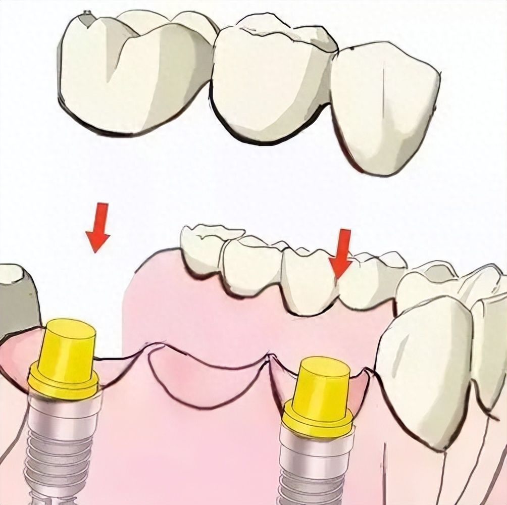 http://m.bstoo.cn/d/file/price/itarnkn9x2xr.jpg