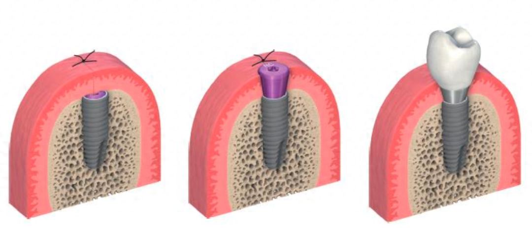 http://m.bstoo.cn/d/file/price/je3ozjaw30m2.jpg