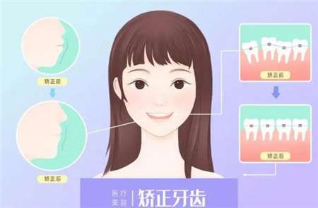 http://m.bstoo.cn/d/file/price/kj4ejl8kbogp.jpg
