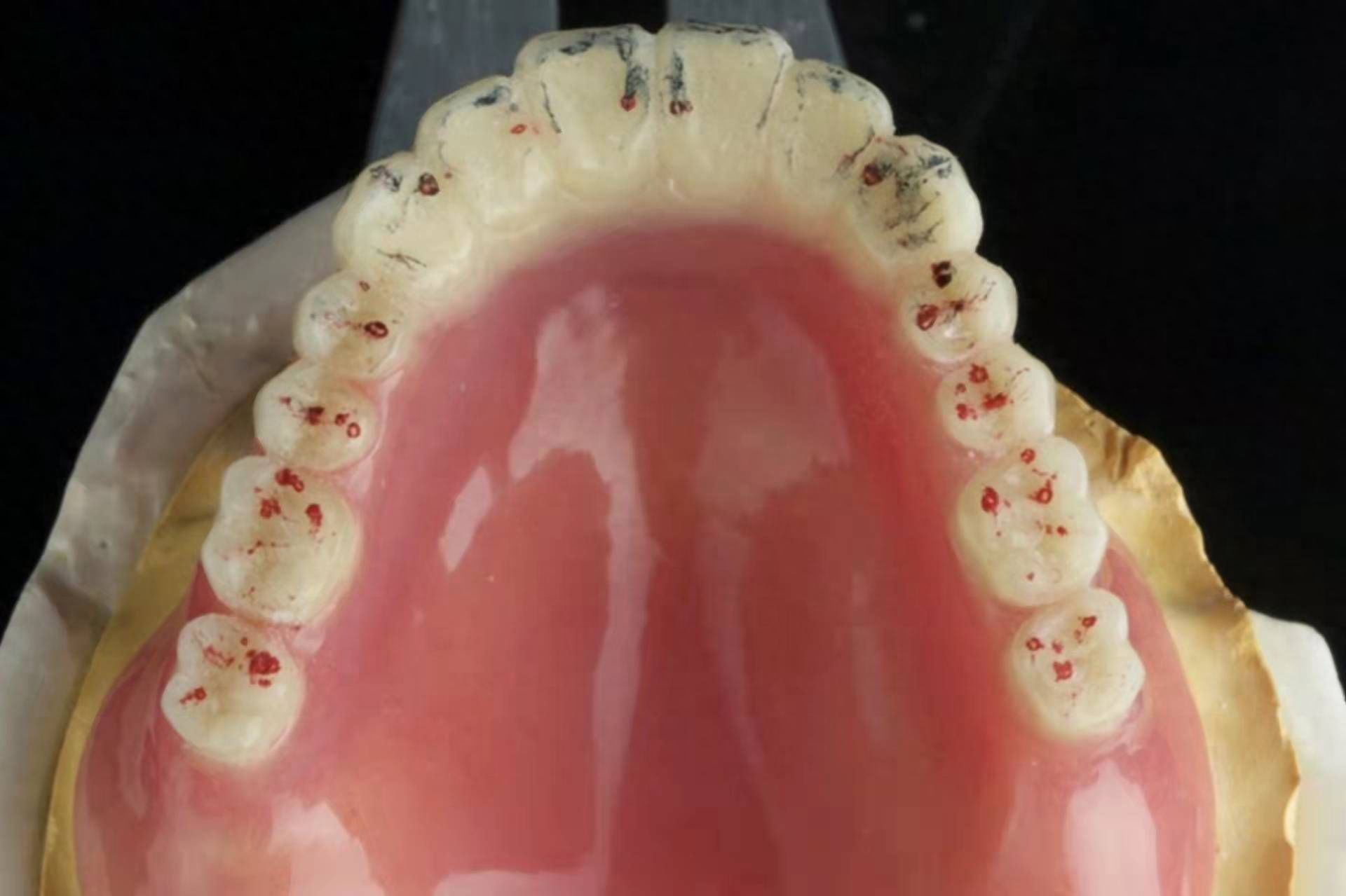 一口種植牙多少錢(qián)？