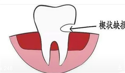 http://m.bstoo.cn/d/file/price/ld4jfs6ogyn4.jpg