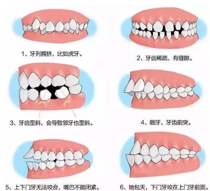 http://m.bstoo.cn/d/file/price/lnozl968r60f.jpg