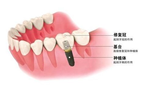 http://m.bstoo.cn/d/file/price/loytxawrj2a2.jpg