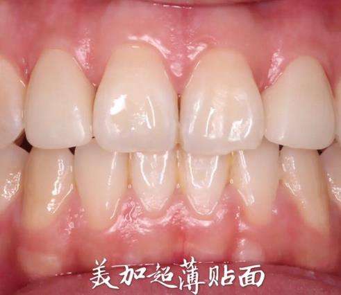 http://m.bstoo.cn/d/file/price/lyii1y492t.jpg