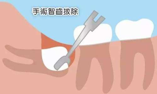 http://m.bstoo.cn/d/file/price/m9gky65iidhr.jpg