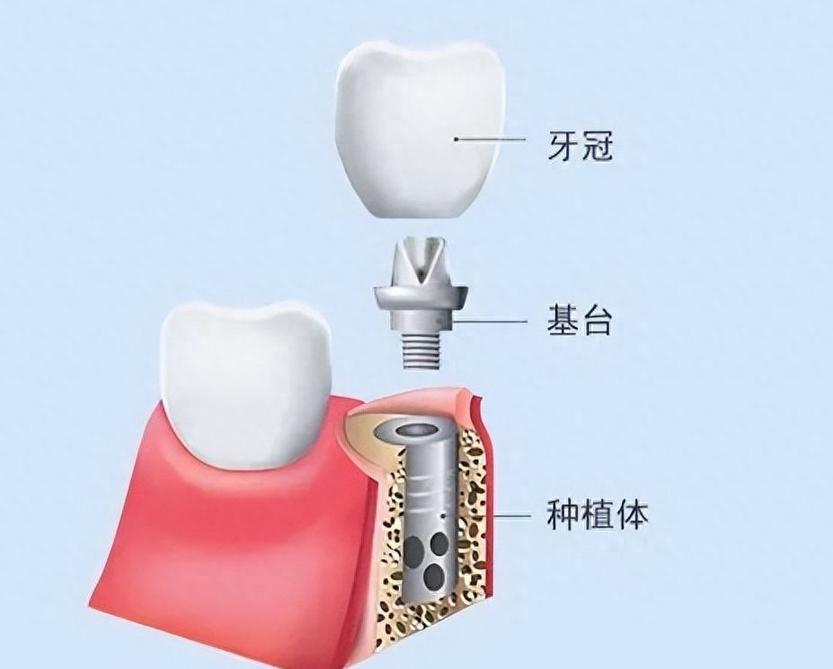 http://m.bstoo.cn/d/file/price/mawaljf8sgv4.jpg