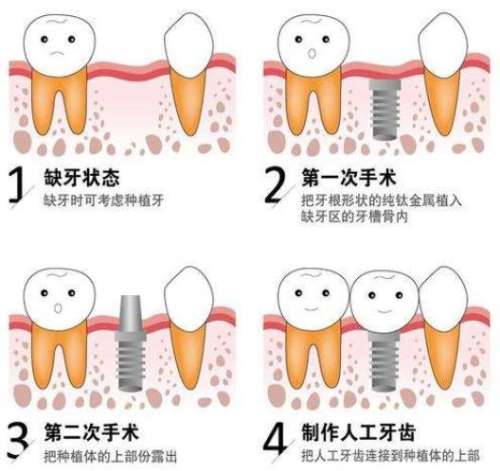 http://m.bstoo.cn/d/file/price/na4a4irh3a4w.jpg