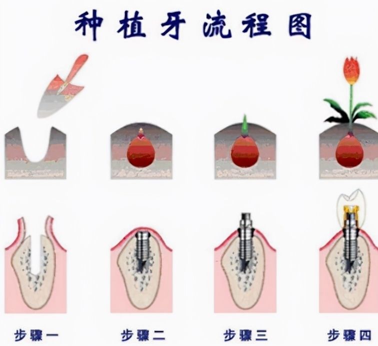 http://m.bstoo.cn/d/file/price/nbyvvwij846e.jpg