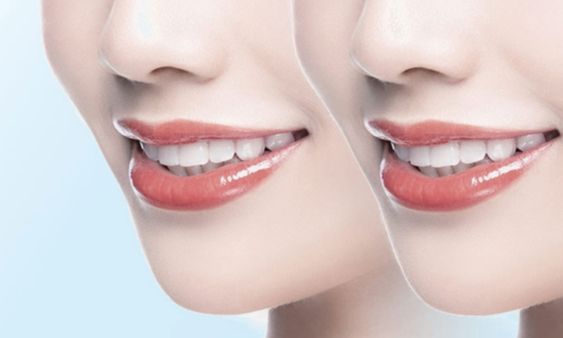 http://m.bstoo.cn/d/file/price/nfle7elg7ld4.jpg