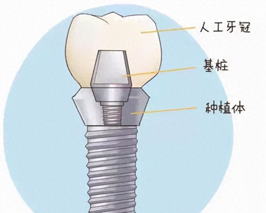 http://m.bstoo.cn/d/file/price/nzt4vncwv2l4.jpg