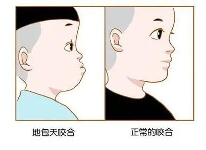 佛山口腔醫(yī)院種植牙價格指南：全口單顆費用詳解