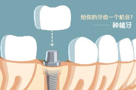 http://m.bstoo.cn/d/file/price/ofix4ms7xmy3.jpg