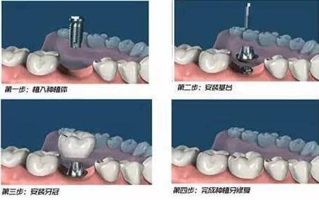 http://m.bstoo.cn/d/file/price/on11z95b419i.jpg