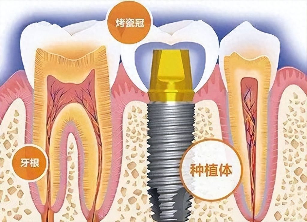 http://m.bstoo.cn/d/file/price/oxkoli3rkgn3.jpg