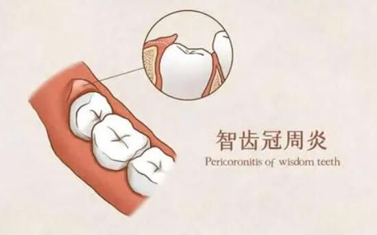 http://m.bstoo.cn/d/file/price/phjzqfbzliss.jpg