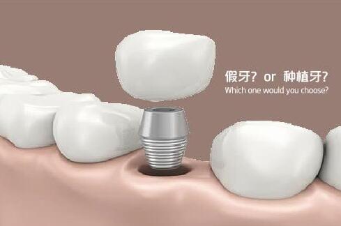 http://m.bstoo.cn/d/file/price/q3imexb1dn72.jpg