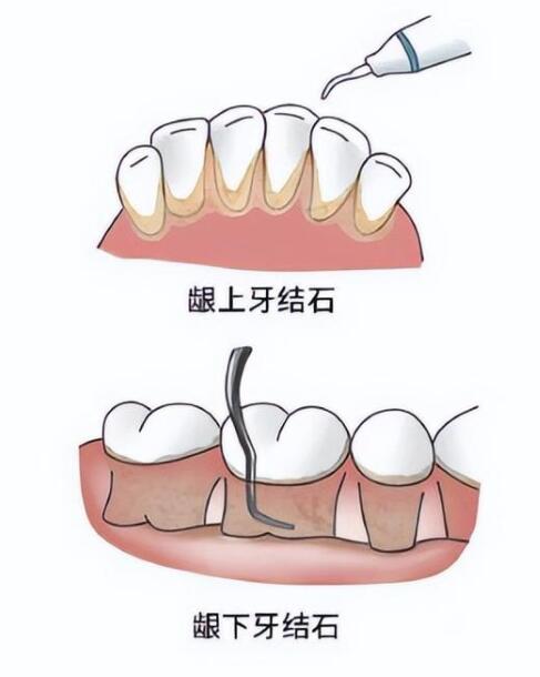 http://m.bstoo.cn/d/file/price/q4o9vyi1ff.jpg