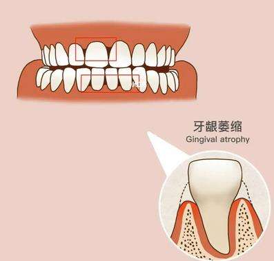 http://m.bstoo.cn/d/file/price/q93b7q3xhgqp.jpg