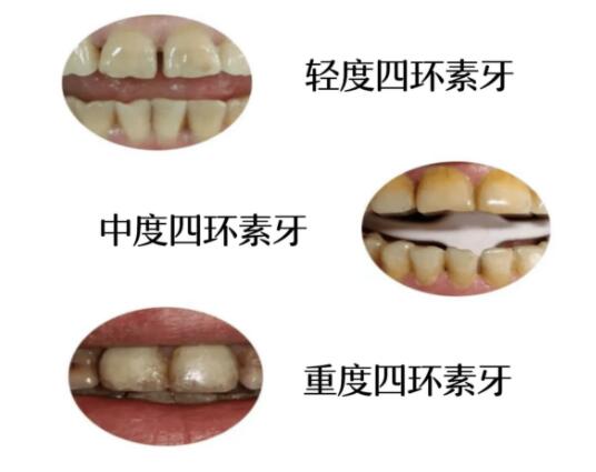 http://m.bstoo.cn/d/file/price/qc3aaxzp4lzn.jpg