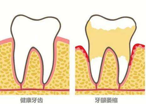 http://m.bstoo.cn/d/file/price/qnqzp5kvl3jf.jpg