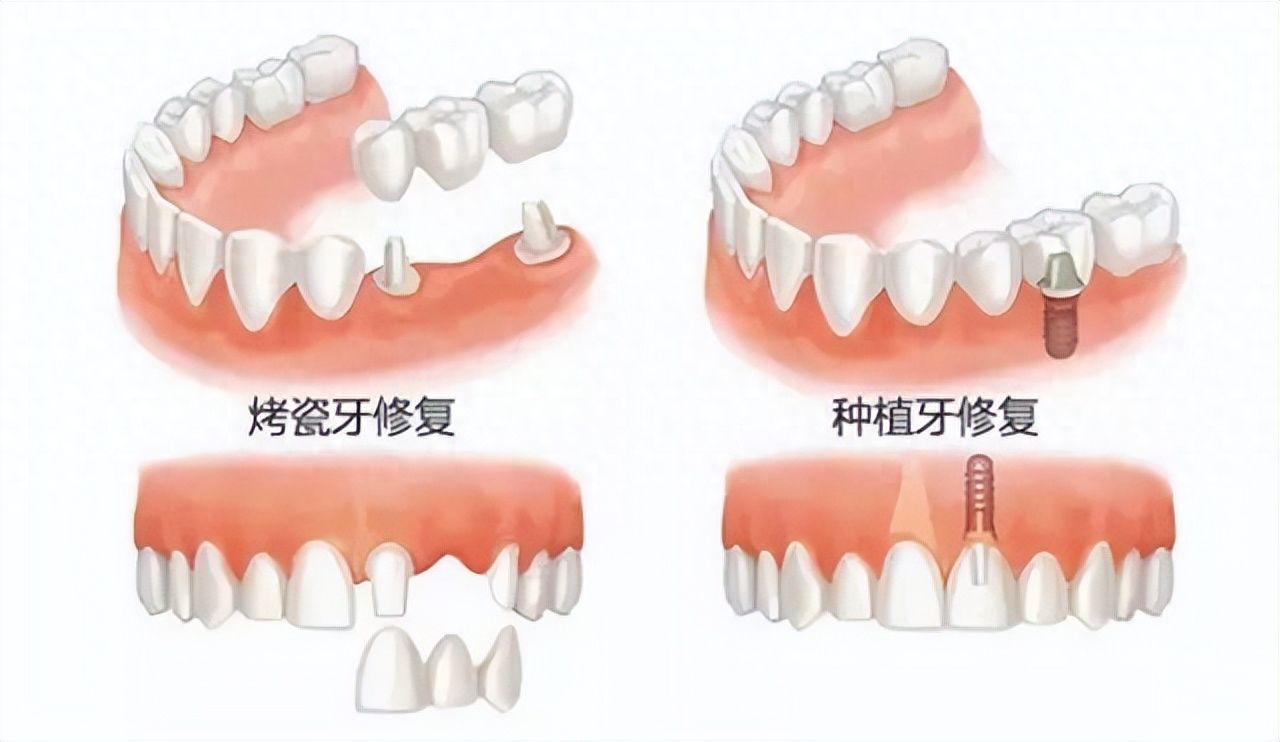 http://m.bstoo.cn/d/file/price/qpd7j8t4808s.jpg