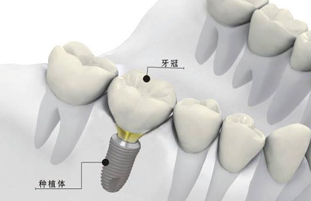 http://m.bstoo.cn/d/file/price/s1m08eua6gk3.jpg