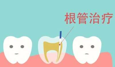 詳解：氧化鋁全瓷牙與二氧化鋯全瓷牙，一顆多少錢？