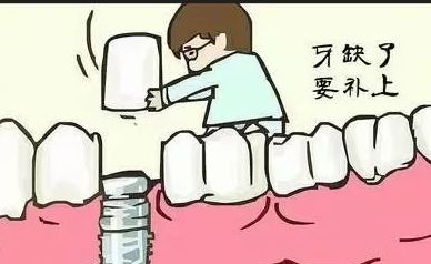 貴港同步口腔種植牙價(jià)格全揭曉！