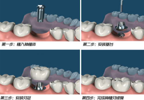 http://m.bstoo.cn/d/file/price/uny86wl661fk.jpg