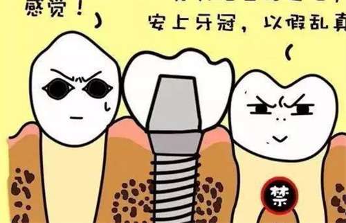 鈷鉻合金烤瓷牙的優(yōu)缺點和價格分析