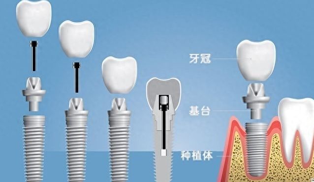 http://m.bstoo.cn/d/file/price/v262o9tzgvaw.jpg