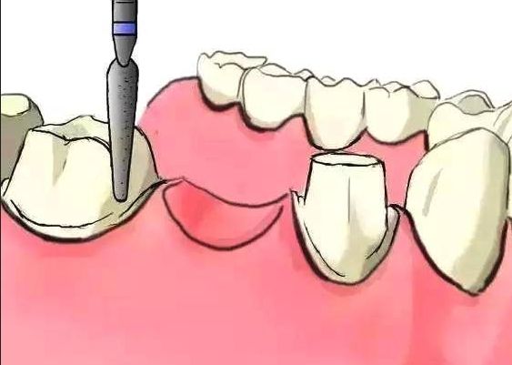 http://m.bstoo.cn/d/file/price/v7m35eos9kz8.jpg