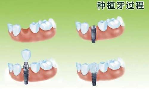http://m.bstoo.cn/d/file/price/vhn5532i6a4t.jpg