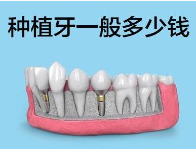 http://m.bstoo.cn/d/file/price/vkdhw0s1pj4y.jpg