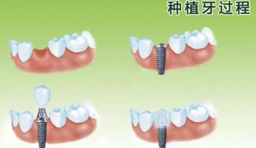 http://m.bstoo.cn/d/file/price/vmyy82vygo94.jpg