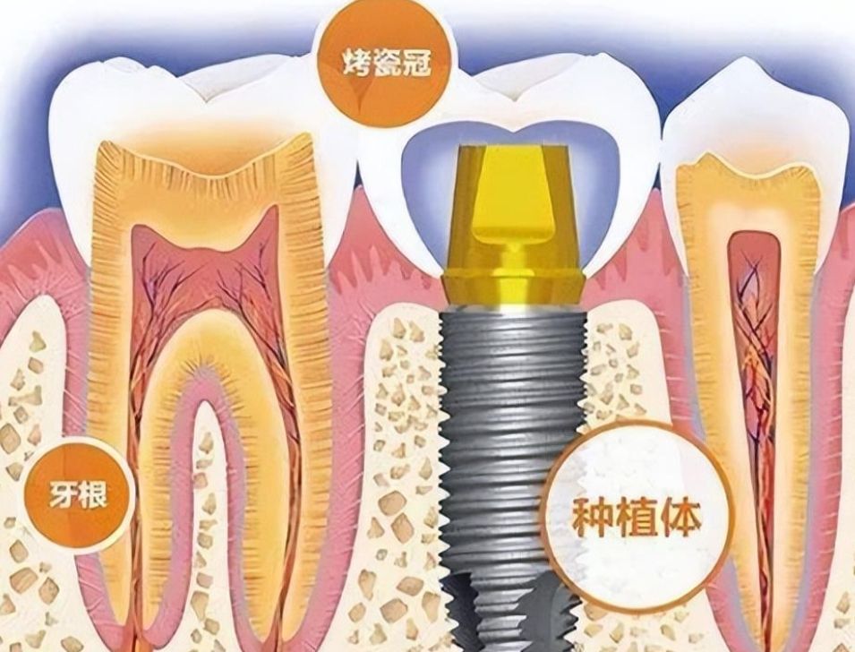 http://m.bstoo.cn/d/file/price/w2yzxluai6er.jpg