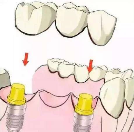 http://m.bstoo.cn/d/file/price/wj2n6ixgs3hk.jpg