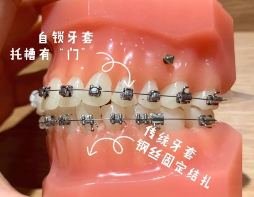 http://m.bstoo.cn/d/file/price/x9jszyik7jil.jpg