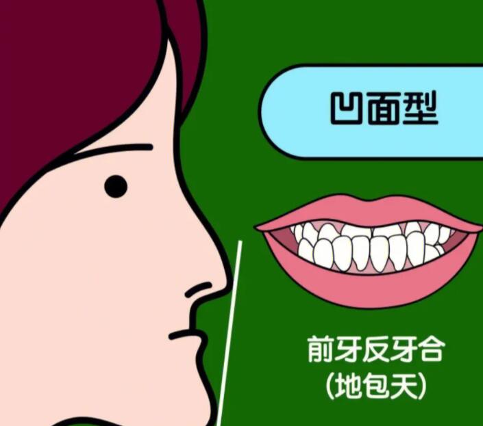http://m.bstoo.cn/d/file/price/xkubszyfjbc0.jpg