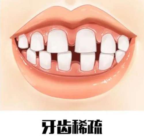 http://m.bstoo.cn/d/file/price/xv1qi8kcaghe.jpg