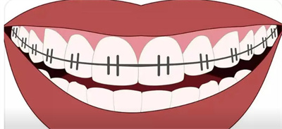 http://m.bstoo.cn/d/file/price/ydfu9jti7uvj.jpg