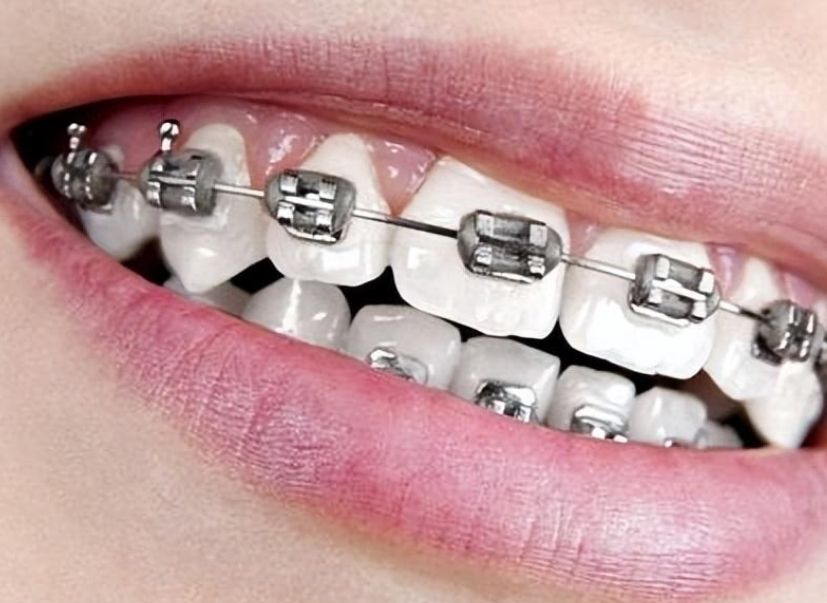 http://m.bstoo.cn/d/file/price/z9dr20km9ram.jpg