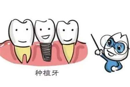 http://m.bstoo.cn/d/file/rank/1otkq2klq1m0.jpg