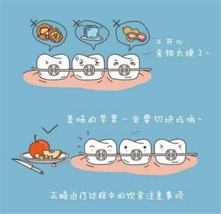 三水人民醫(yī)院種植牙價格及醫(yī)生解答