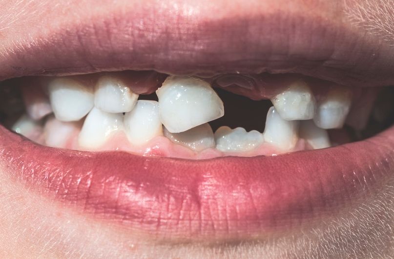 寧德中富口腔醫(yī)院靠譜嗎？深度揭秘：醫(yī)生實力、特色項目及收費一覽！
